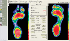Footmaxx Metascan treatment in the Cuyahoga County, OH: Beachwood (Woodmere, Orange, Warrensville Heights, Highland Hills, Shaker Heights, Pepper Pike, Moreland Hills, Bedford Heights, MT Pleasant) and Mayfield Heights (Gates Mills, Hunting Valley, Lyndhurst, Willoughby Hills, South Euclid, Chesterland, Wickliffe, Richmond Heights), Lake County, OH: Mentor (Willoughby, Kirtland, Waite Hill, Eastlake, Grand River, Painesville, Lakeline, Concord), and Summit County, OH: Tallmadge (Munroe Falls, Goodyear Heights, Chapel Hill, Arlington, Middlebury, Akron, Brimfield, Kent) areas