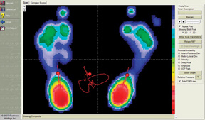 Footmaxx Metascan Diagnostics in the Cuyahoga County, OH: Beachwood (Woodmere, Orange, Warrensville Heights, Highland Hills, Shaker Heights, Pepper Pike, Moreland Hills, Bedford Heights, MT Pleasant) and Mayfield Heights (Gates Mills, Hunting Valley, Lyndhurst, Willoughby Hills, South Euclid, Chesterland, Wickliffe, Richmond Heights), Lake County, OH: Mentor (Willoughby, Kirtland, Waite Hill, Eastlake, Grand River, Painesville, Lakeline, Concord), and Summit County, OH: Tallmadge (Munroe Falls, Goodyear Heights, Chapel Hill, Arlington, Middlebury, Akron, Brimfield, Kent) areas