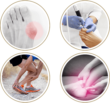 Podiatric services and procedures in the Cuyahoga County, OH: Beachwood (Woodmere, Orange, Warrensville Heights, Highland Hills, Shaker Heights, Pepper Pike, Moreland Hills, Bedford Heights, MT Pleasant) and Mayfield Heights (Gates Mills, Hunting Valley, Lyndhurst, Willoughby Hills, South Euclid, Chesterland, Wickliffe, Richmond Heights), Lake County, OH: Mentor (Willoughby, Kirtland, Waite Hill, Eastlake, Grand River, Painesville, Lakeline, Concord), and Summit County, OH: Tallmadge (Munroe Falls, Goodyear Heights, Chapel Hill, Arlington, Middlebury, Akron, Brimfield, Kent) areas