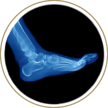 Digital X-Ray procedure in the Cuyahoga County, OH: Beachwood (Woodmere, Orange, Warrensville Heights, Highland Hills, Shaker Heights, Pepper Pike, Moreland Hills, Bedford Heights, MT Pleasant) and Mayfield Heights (Gates Mills, Hunting Valley, Lyndhurst, Willoughby Hills, South Euclid, Chesterland, Wickliffe, Richmond Heights), Lake County, OH: Mentor (Willoughby, Kirtland, Waite Hill, Eastlake, Grand River, Painesville, Lakeline, Concord), and Summit County, OH: Tallmadge (Munroe Falls, Goodyear Heights, Chapel Hill, Arlington, Middlebury, Akron, Brimfield, Kent) areas