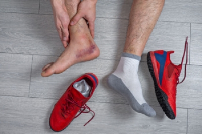 Managing a Sprained Ankle
