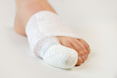 Reducing and Recovering From Sports Injuries of the Toe