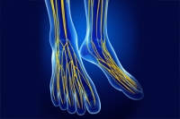 Causes of Nerve Pain in the Feet
