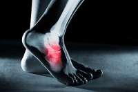 All About Tarsal Tunnel Syndrome