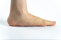 What Are the Signs of Flat Feet?