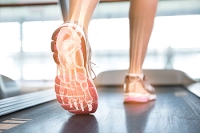 What is an Overpronation?